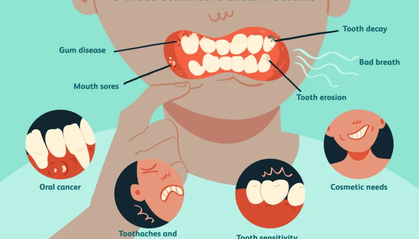 Common Dental Issues